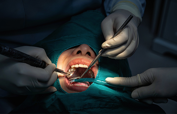 TMJ Treatment - Advanced Periodontics